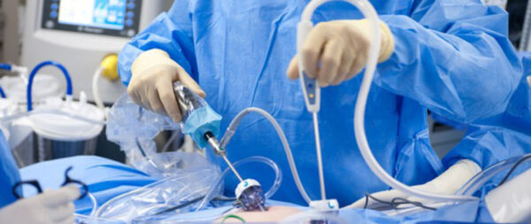 laparoscopy camera